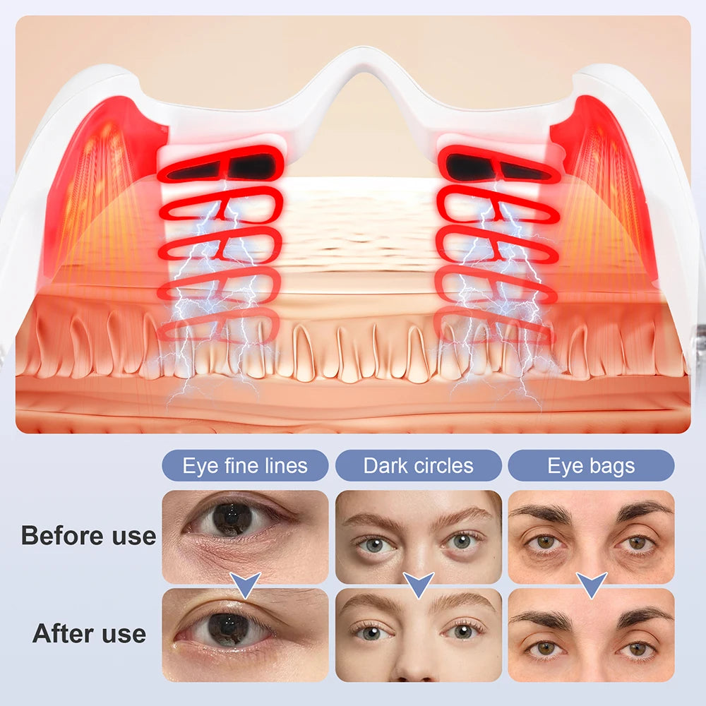 La Solution Somniora pour Réduire Cernes Poches  Masseur Oculaire EMS 3D Chauffant  Ultra‑Léger